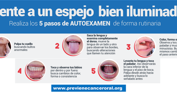 Cáncer oral: la importancia de la prevención