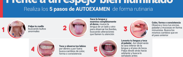 Cáncer oral: la importancia de la prevención