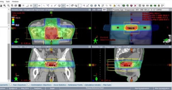 Carrera de Tecnología Médica utiliza simulador de radioterapia para realizar docencia