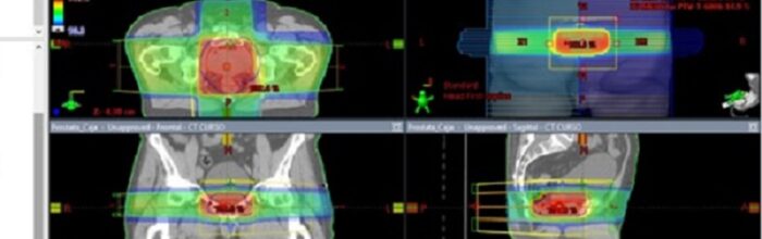 Carrera de Tecnología Médica utiliza simulador de radioterapia para realizar docencia