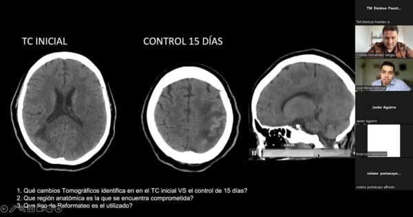 Tecnología Médica realizó clase espejo «Casos Clínicos en exploraciones tomográficas de cerebro»