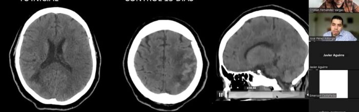 Tecnología Médica realizó clase espejo «Casos Clínicos en exploraciones tomográficas de cerebro»